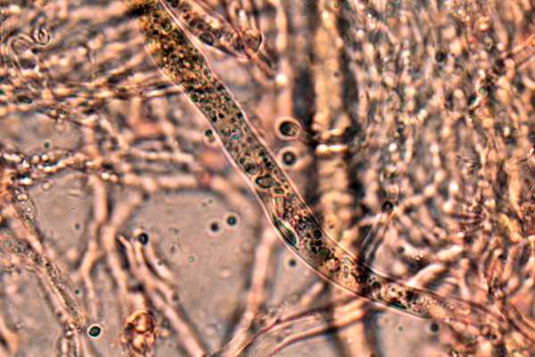 Gloeocystidiellum karstenii? (Laxitextum bicolor)